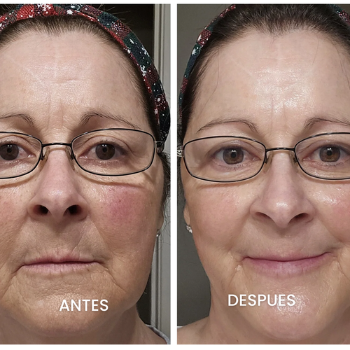 CREMA FACIAL REJUVENECEDORA COREANA