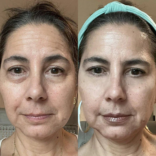 INFINITE NAD + RETINOL