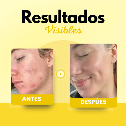 Bálsamo de Sebo de Res